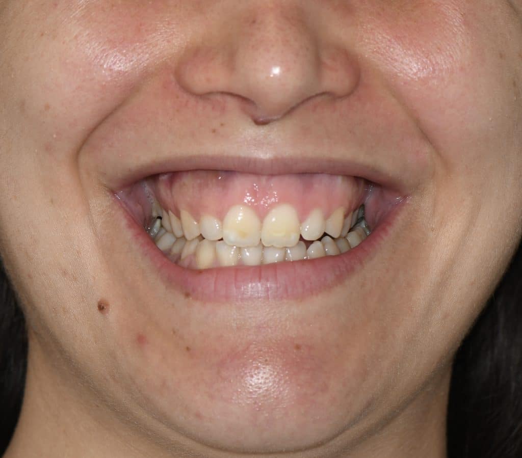 BD596314-F40C-447B-8B62-B36DB83CA73E