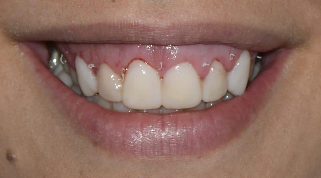 BFEADA99-2873-4A0F-9015-DB90B79DF072