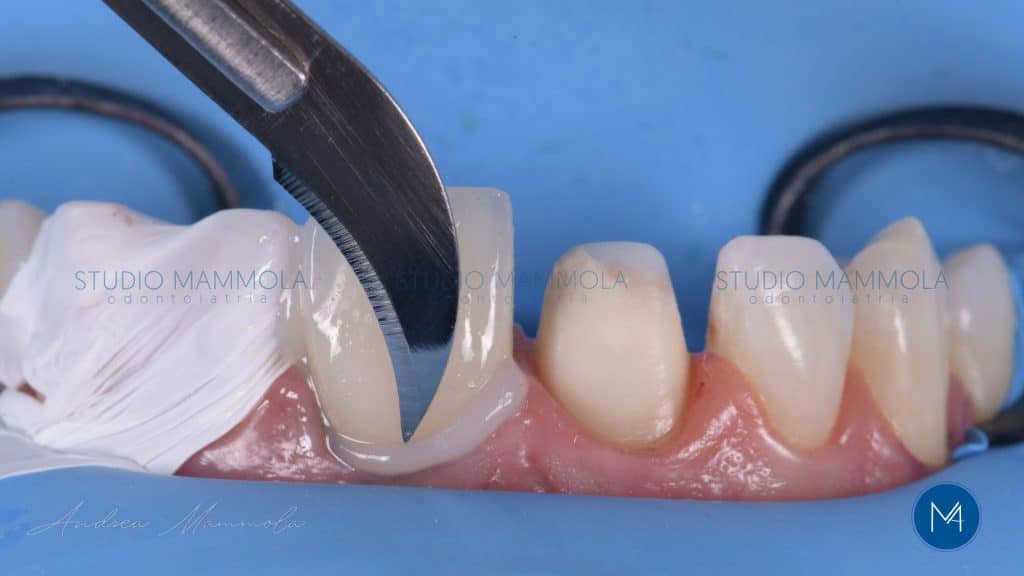 C65319B4-7591-480A-9004-5EB913FD9CA2