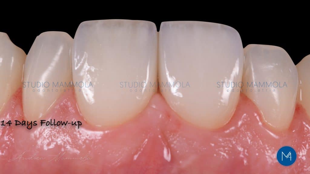 CD18ED24-8CC8-43B9-85C0-693FED11ABC0