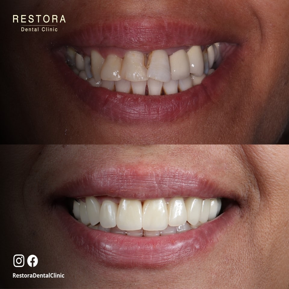 EAFA8824-31CC-4CCD-9E8F-C1B6F3C2D6D4