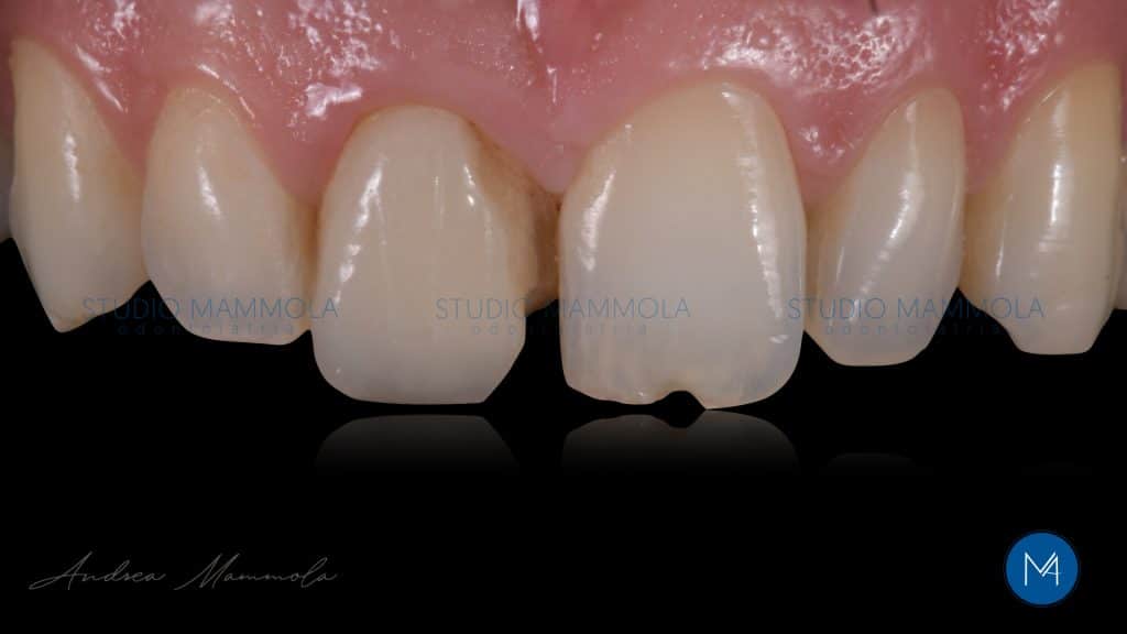 EB466F51-211C-4322-B2E9-7CB6DBC00E77