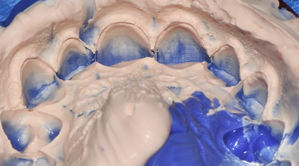 EDB5AE14-3D85-4BE2-B02F-9FE9D97616F0