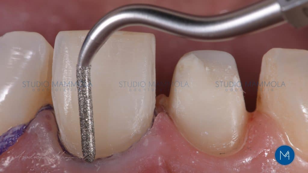 F55BE235-E9FC-4D90-BD90-18D35A1C83B0