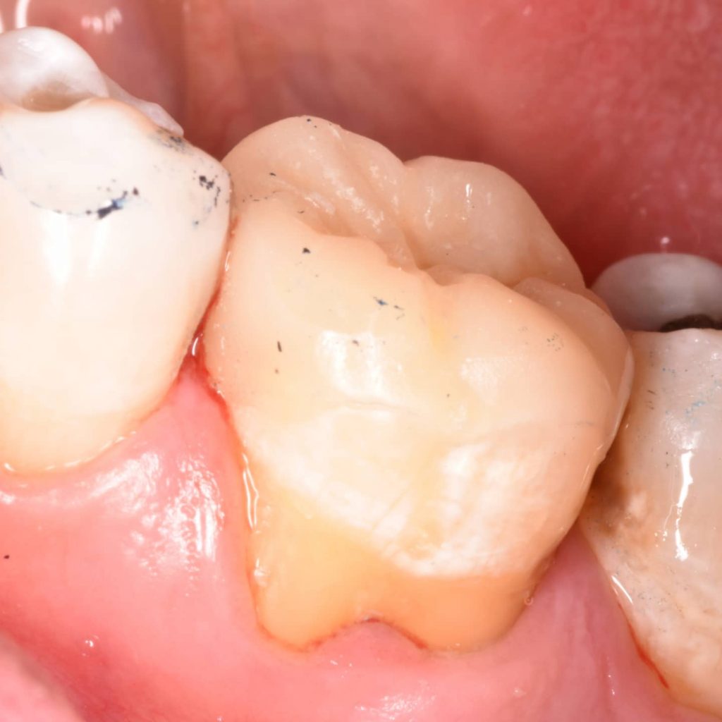 IMG_20211118_202519_216