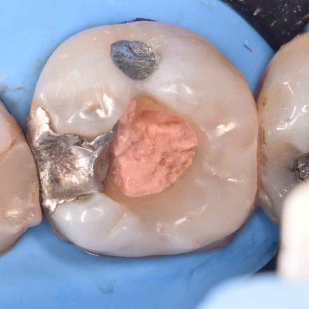 IMG_20211118_202519_221