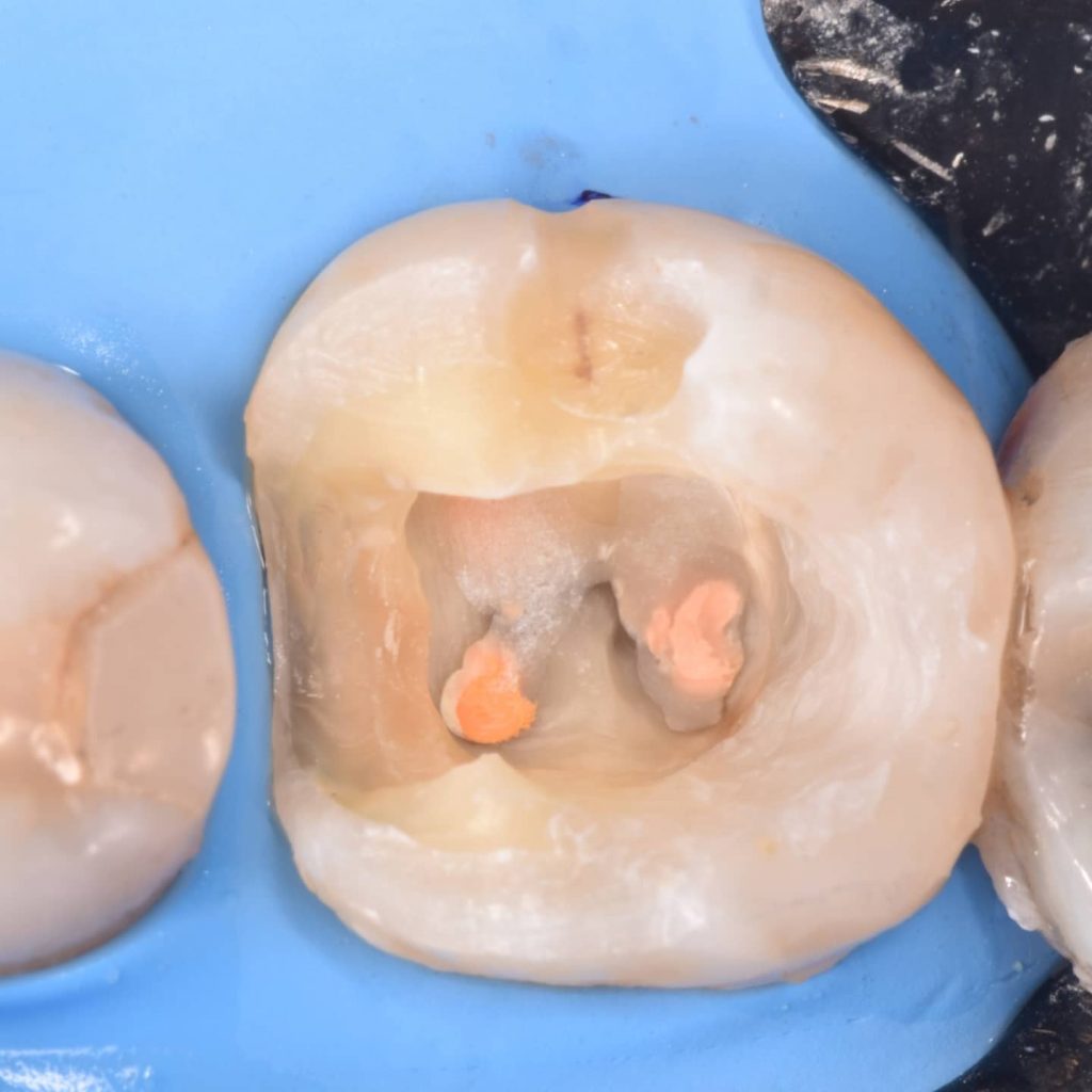 IMG_20211118_202519_235