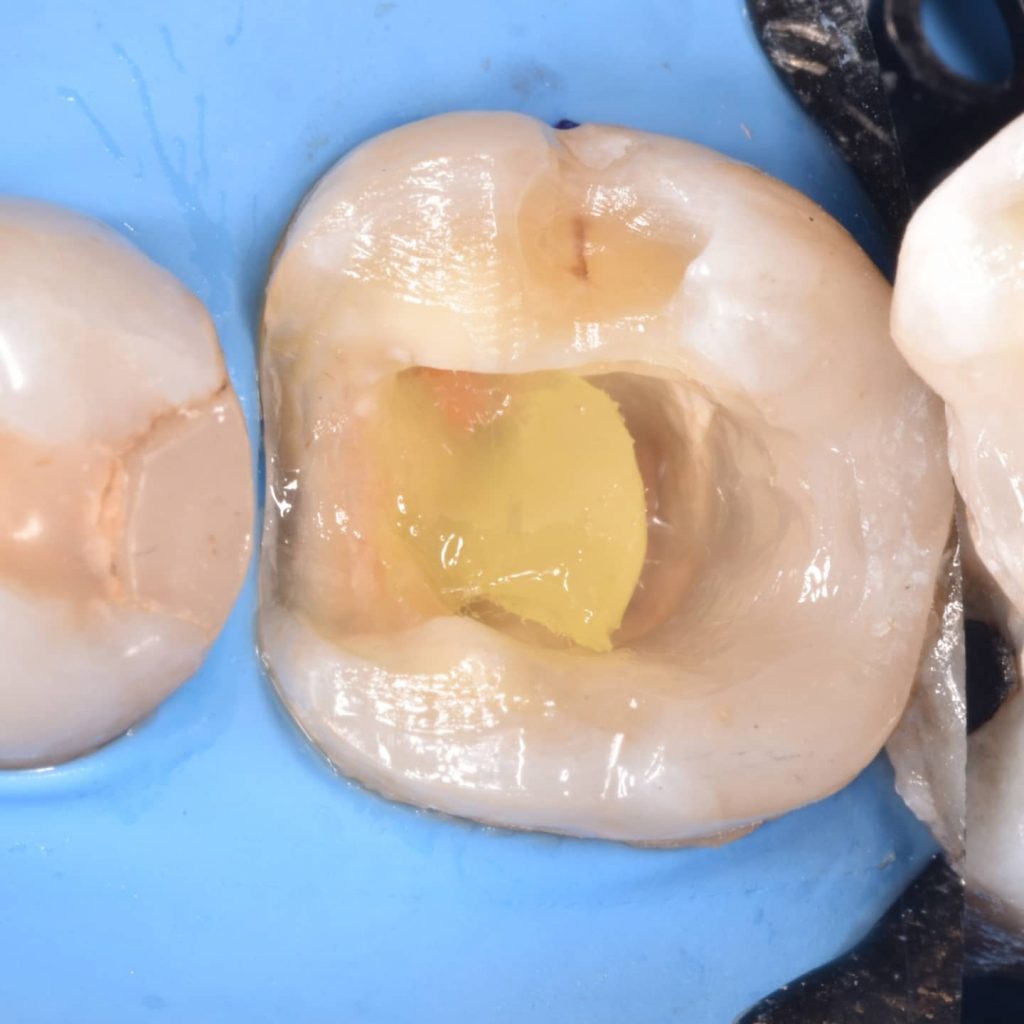 IMG_20211118_202519_247