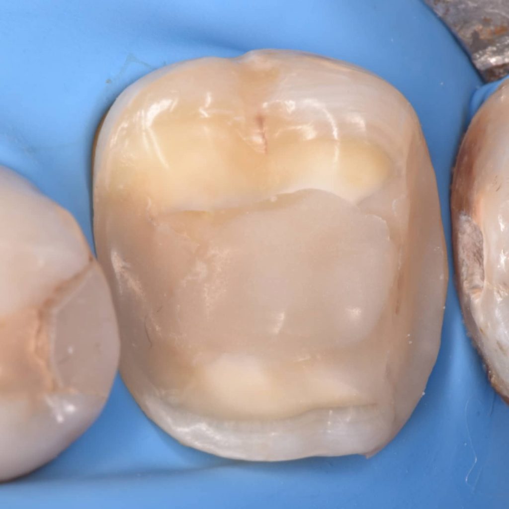 IMG_20211118_202519_250