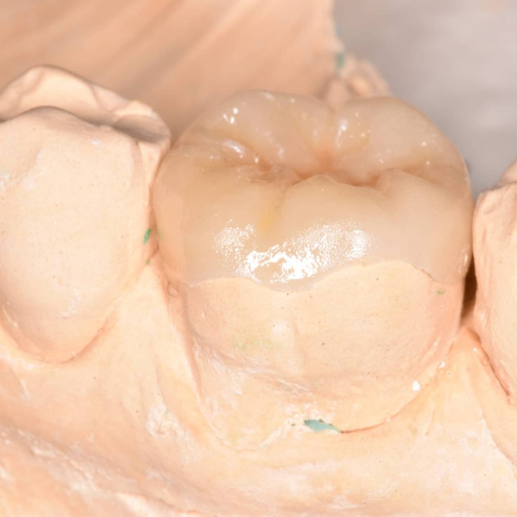 IMG_20211118_202519_253