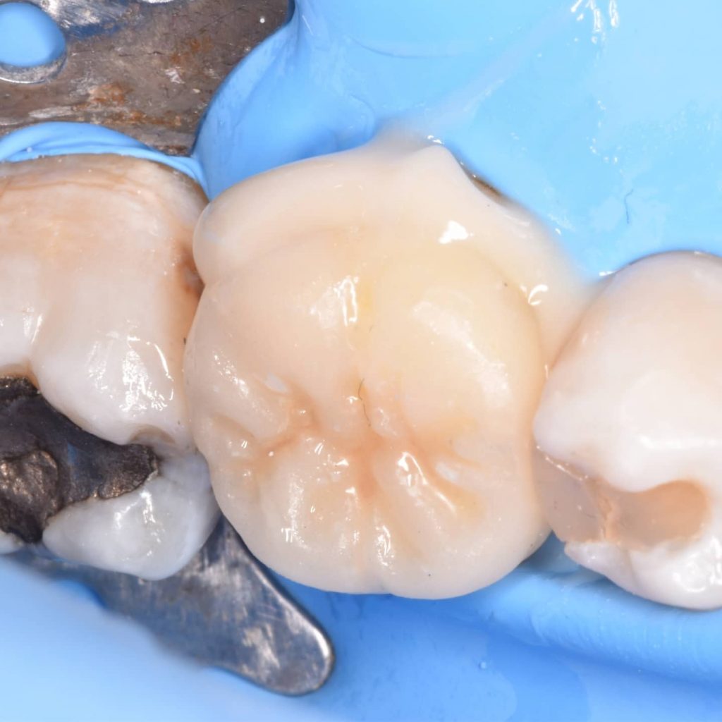 IMG_20211118_202519_257