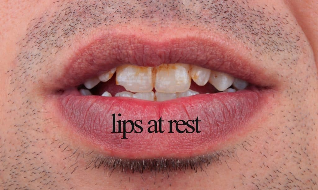 inbound2440440564253177700