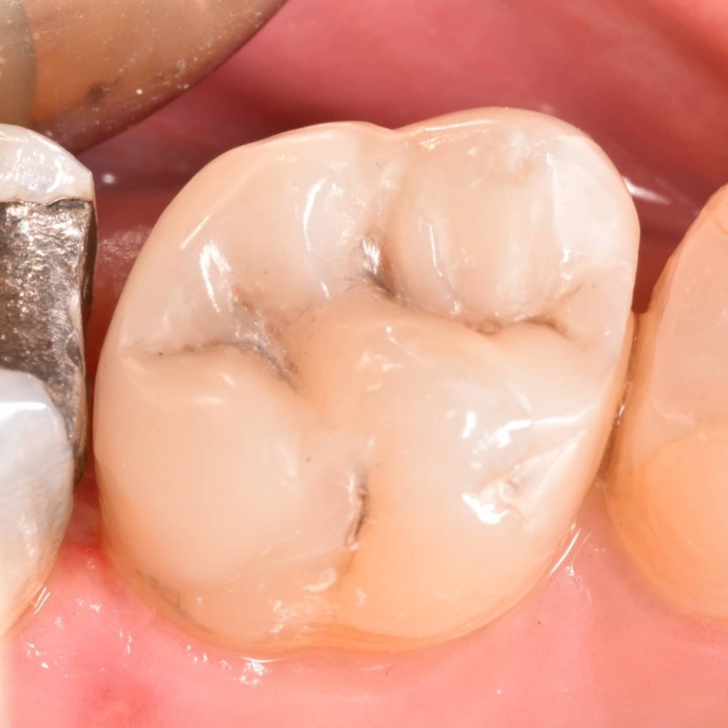 inbound2704456111381478710