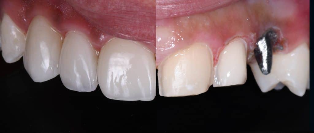 inbound2891671249306230983