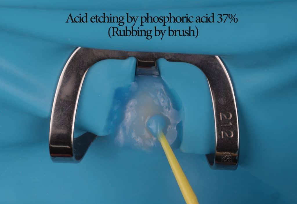 inbound3505567910659965185