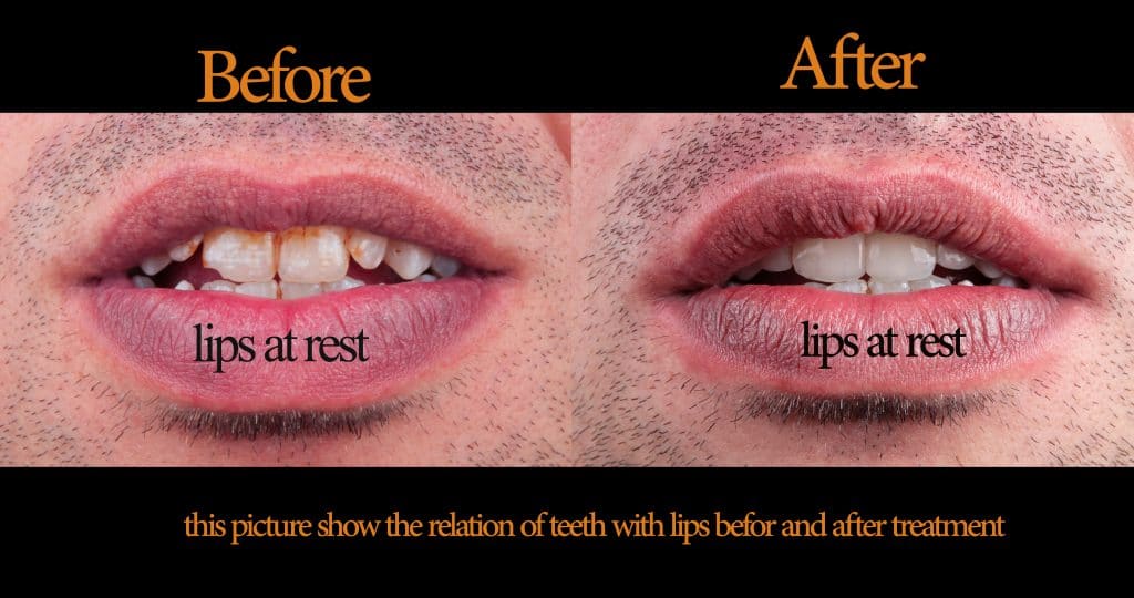 inbound3832111818447349716