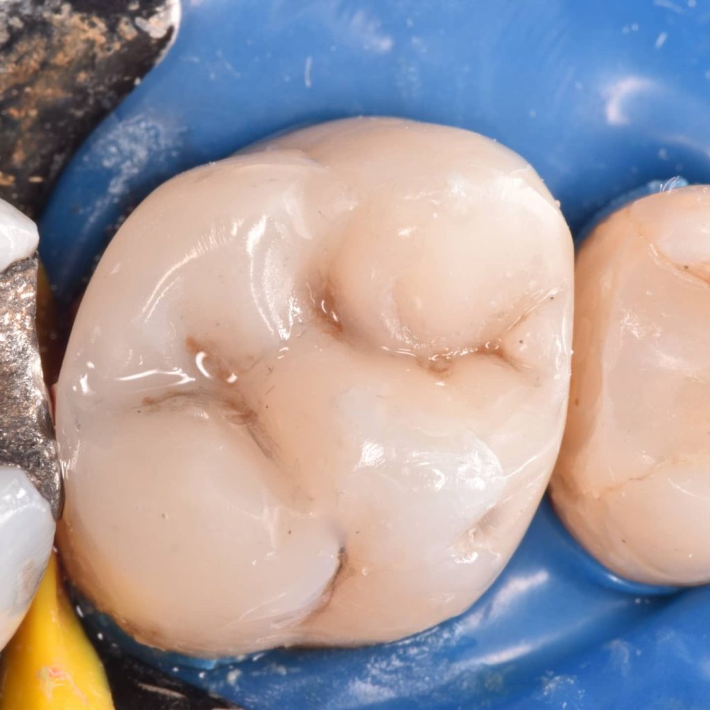 inbound468437610403598217