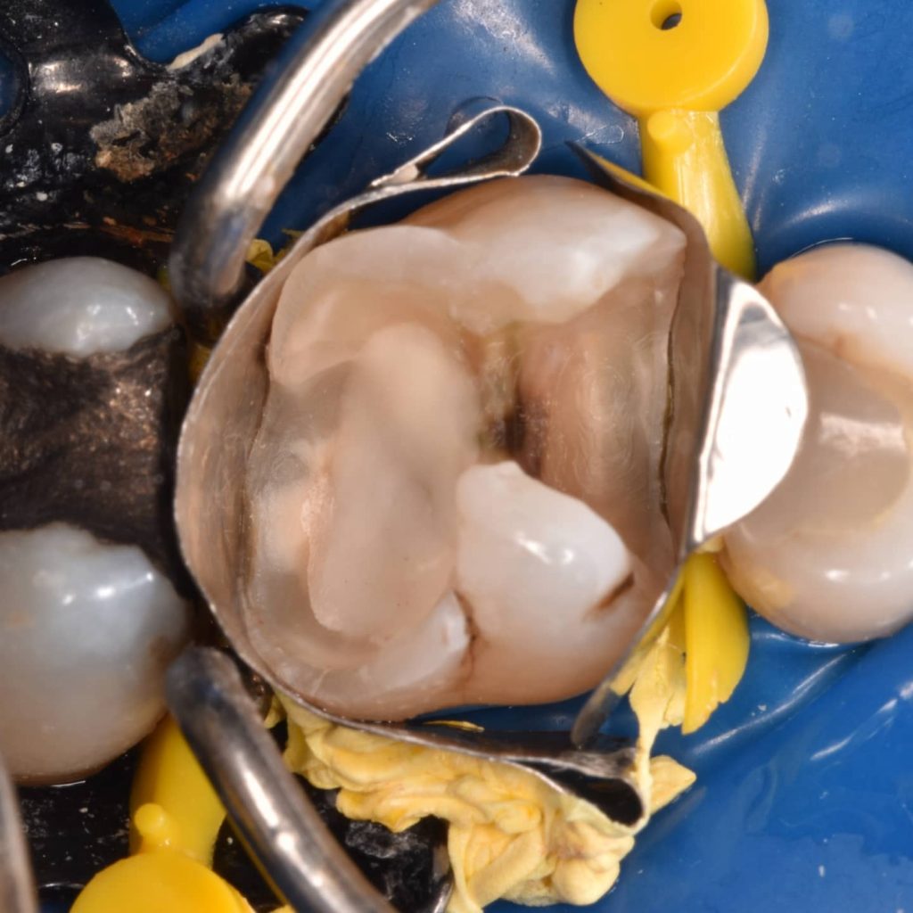 inbound4687410893085688037