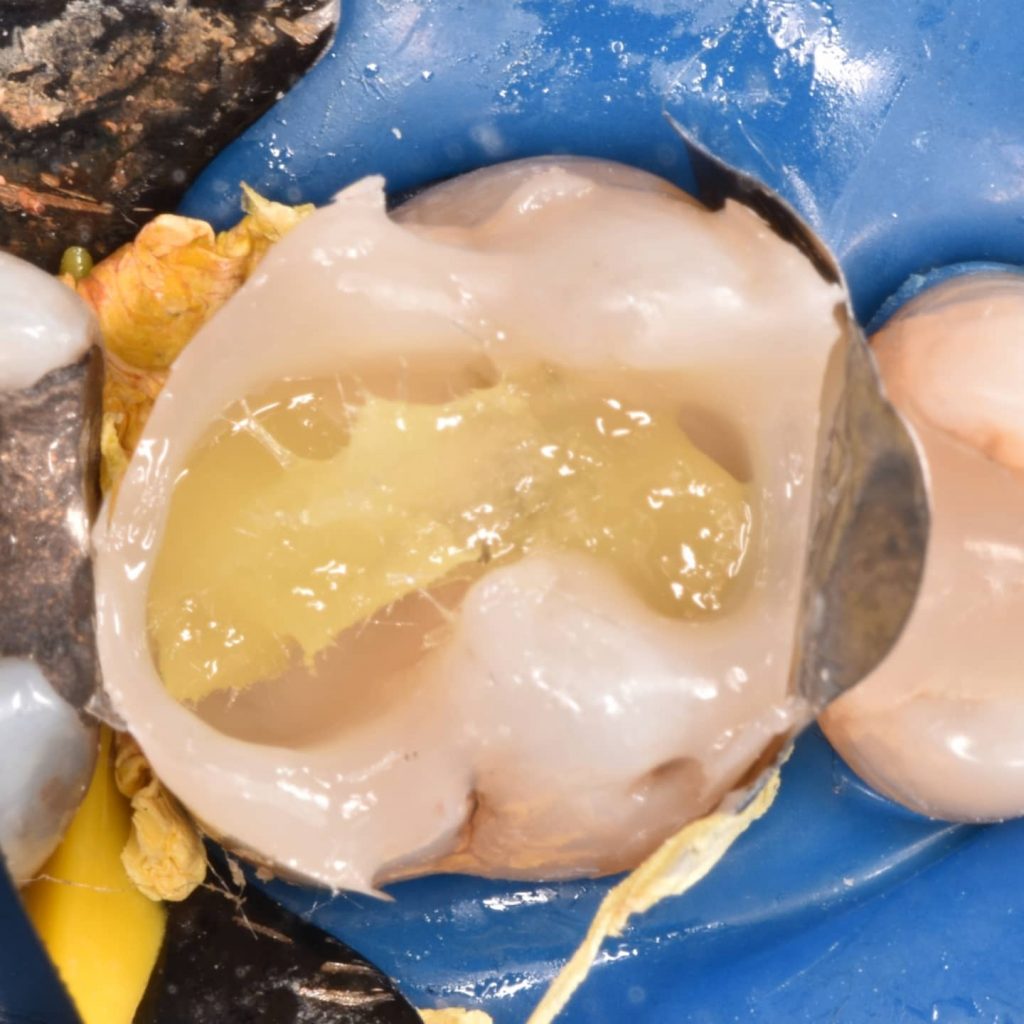 inbound4813629238988317933