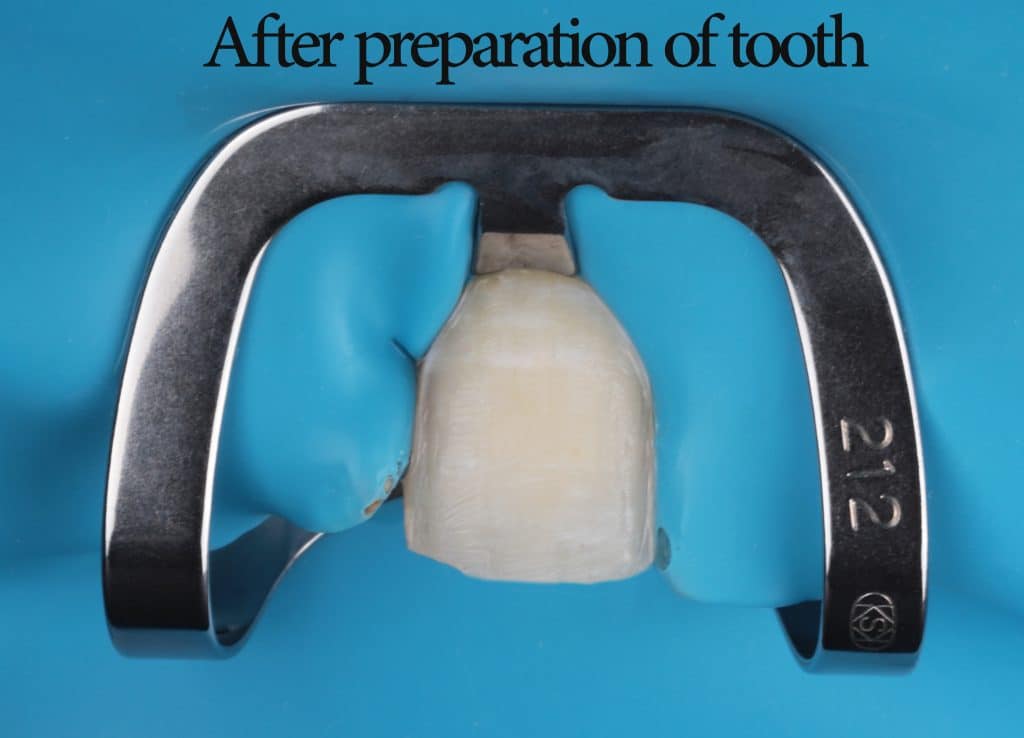 inbound7229182378049874623