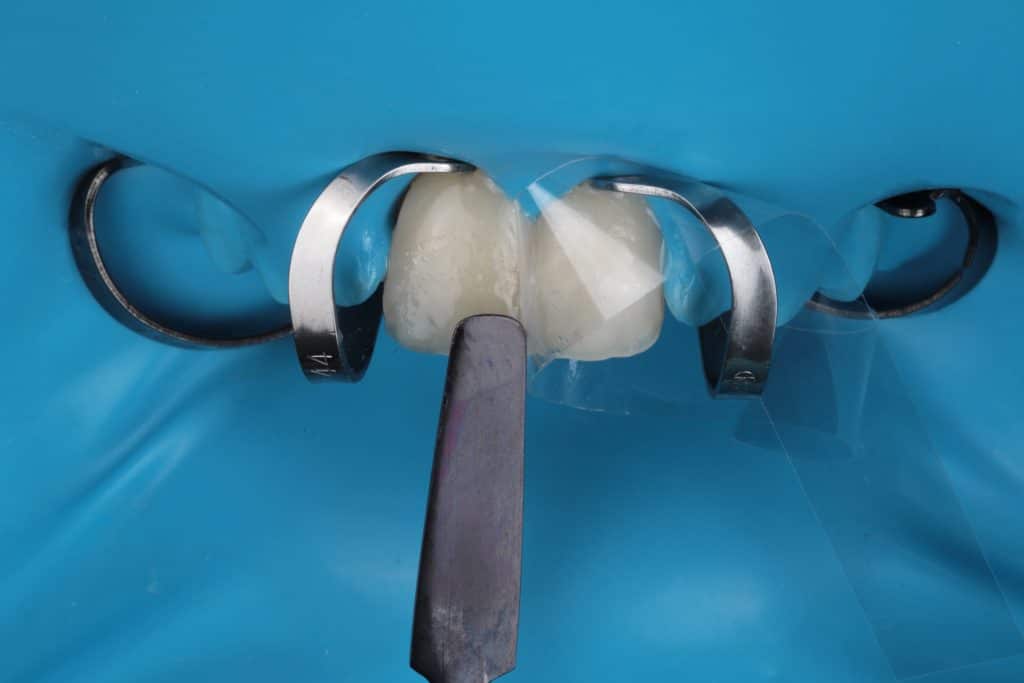 inbound7632411718504344511