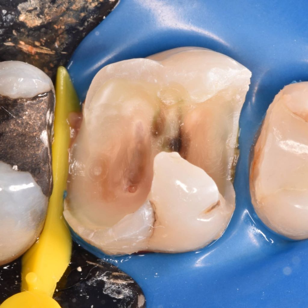 inbound8257315624047976925