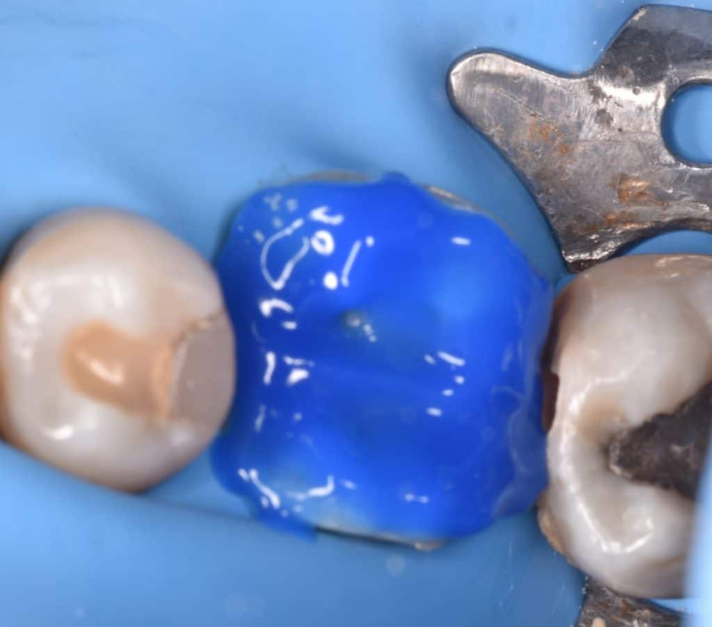 ٢٠٢١١١١٨_١٨٥٧٣١