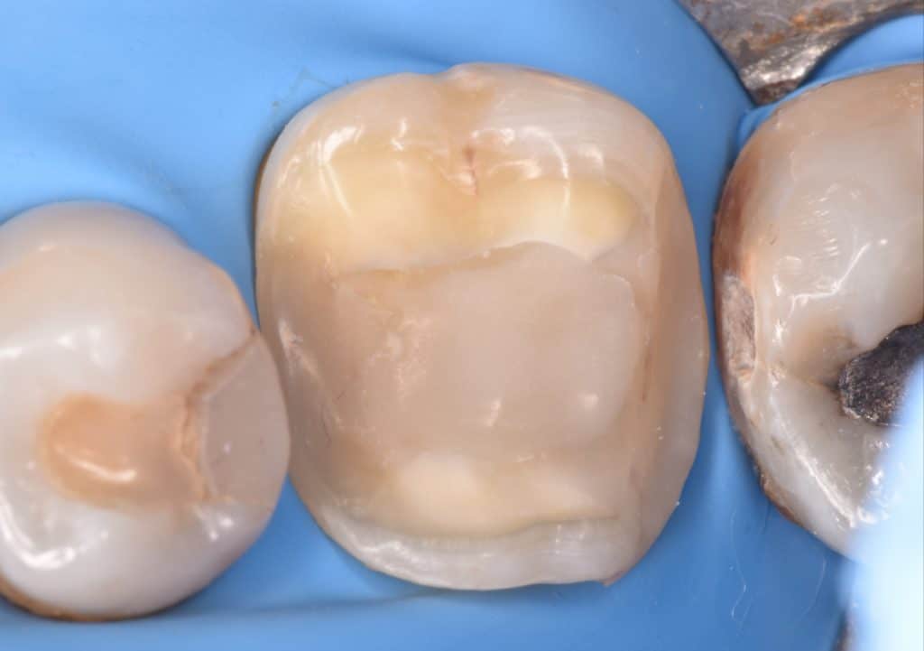 ٢٠٢١١١١٨_١٩٠٠٠٤