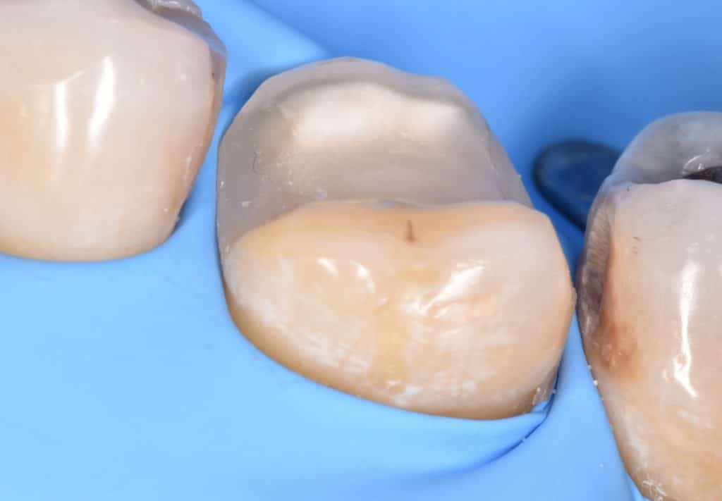 ٢٠٢١١١١٨_١٩٠٠٥٤