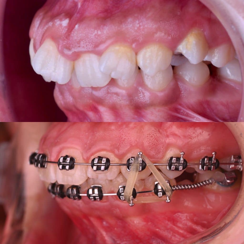 19A39125-82AF-4A13-9117-631A10B40BA3