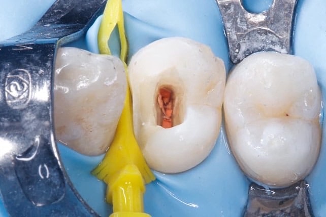 44B65489-4660-4371-A714-512DBDDDB32F