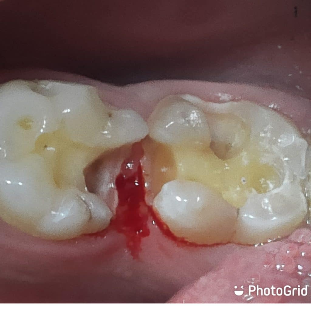 PhotoGrid_Plus_1635929689610