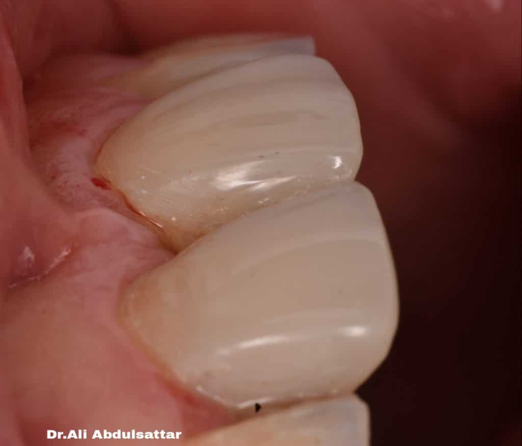 Picsart_21-12-26_22-28-09-345