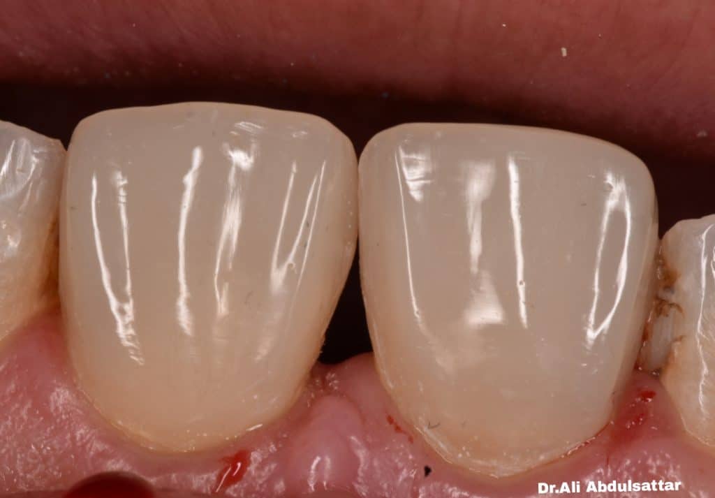 Picsart_21-12-26_22-28-59-856