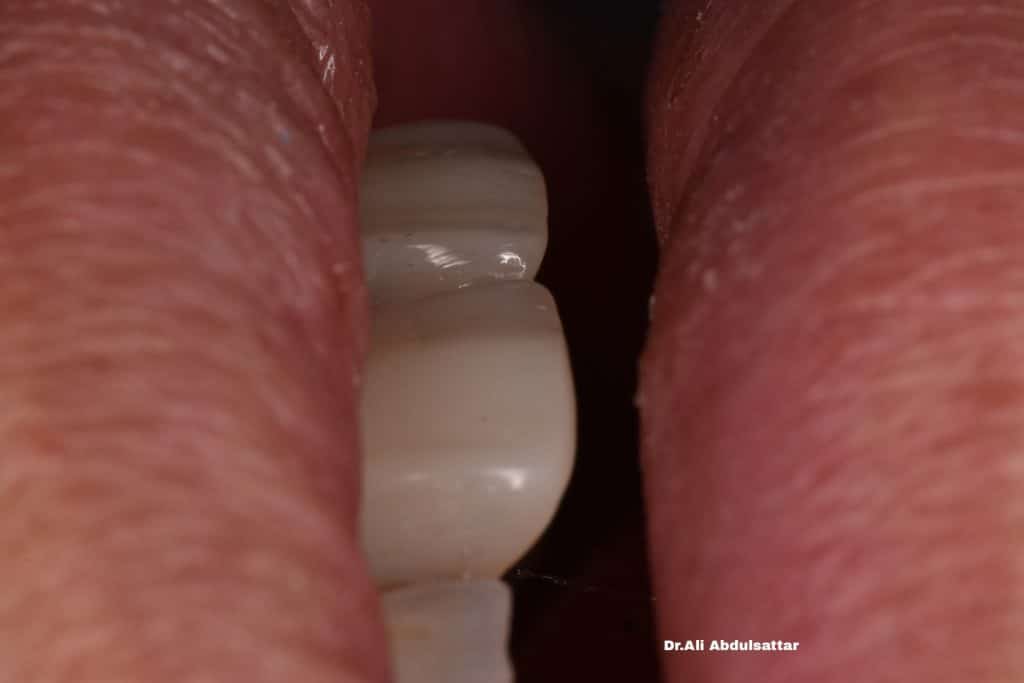 Picsart_21-12-26_22-29-36-422