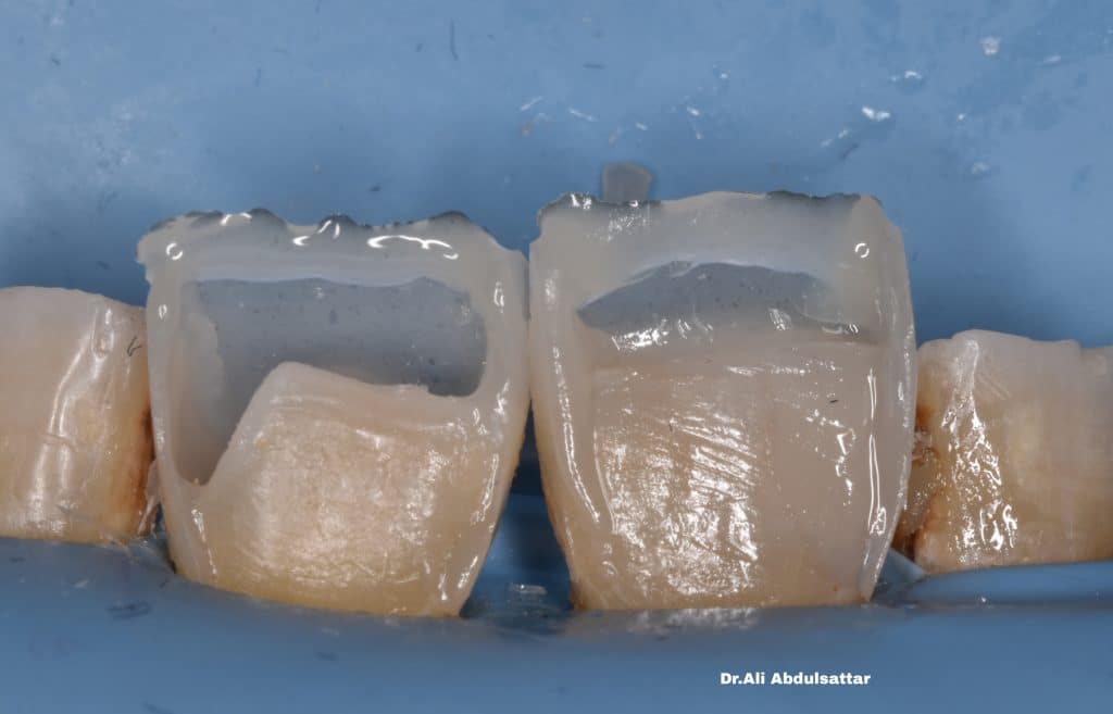 Picsart_21-12-26_22-30-12-643