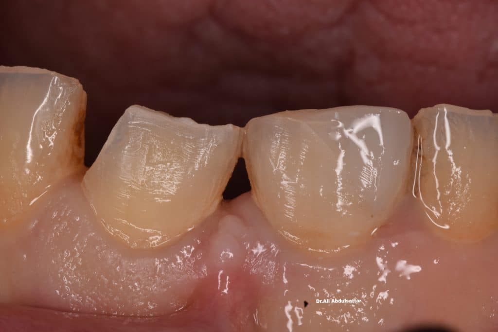 Picsart_21-12-26_22-32-03-363