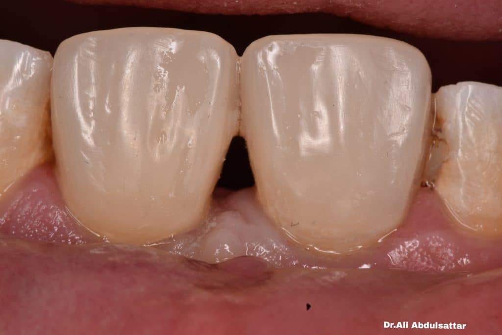 Picsart_21-12-26_22-32-33-461