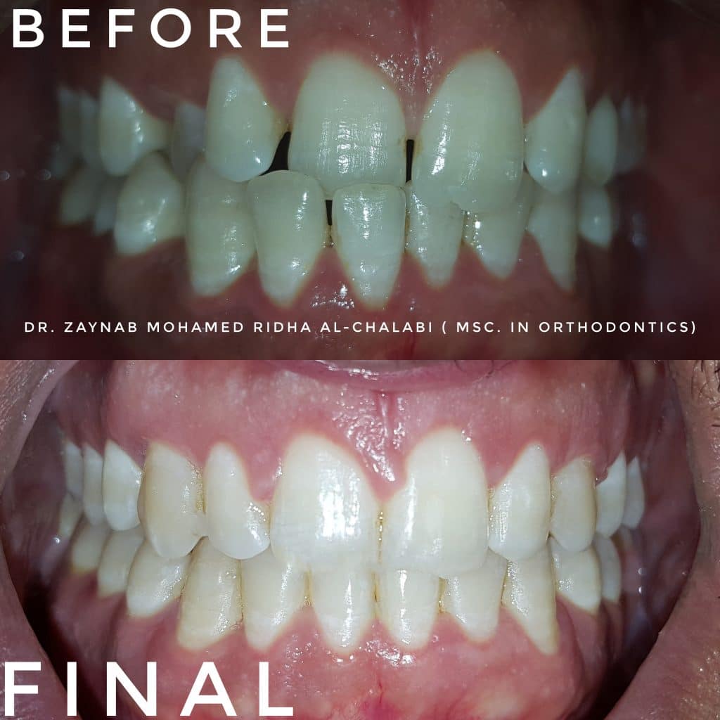 inbound1809030459357236497