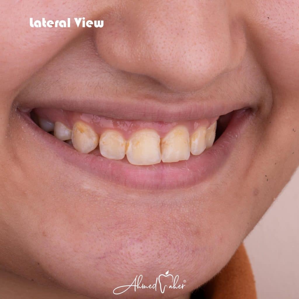 9D42E9F3-03E0-4C78-8100-AC116117C978