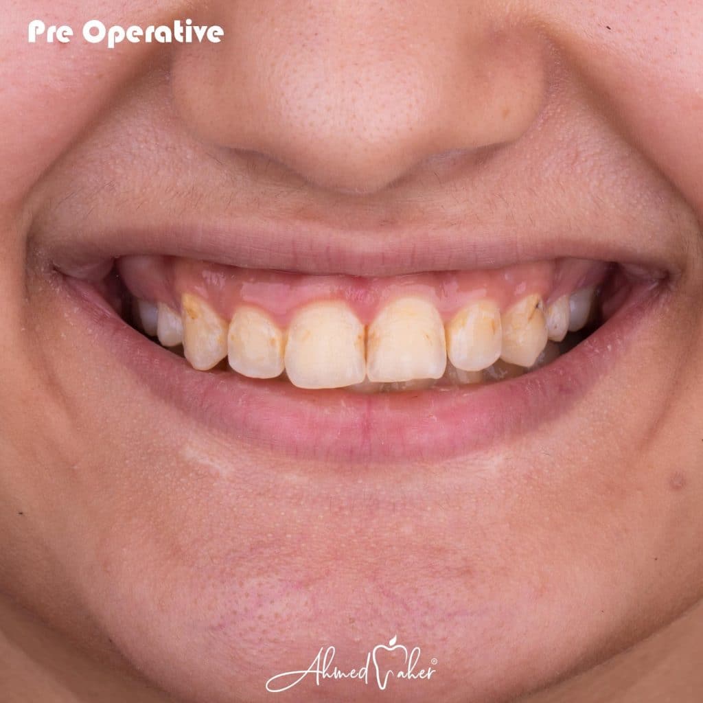 AA7EE880-06F3-40E7-BB32-59979F50519D