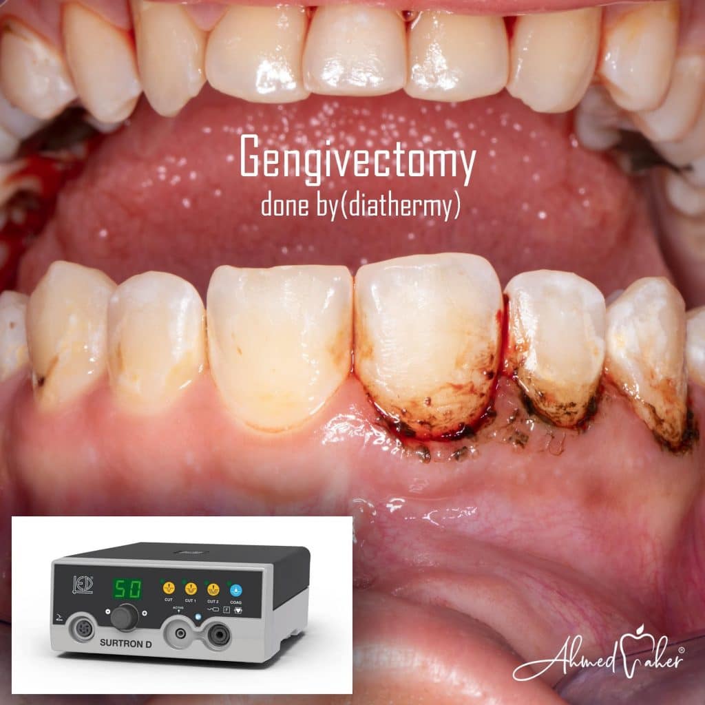 EDE55259-04EF-4364-A575-7A371C32E802