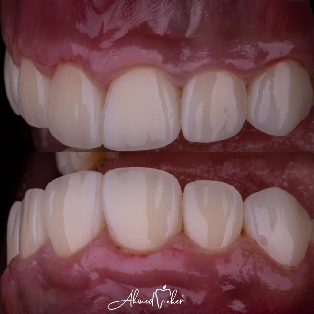 F93F5DD1-3DB0-442B-B9DA-7CE224B15ECE