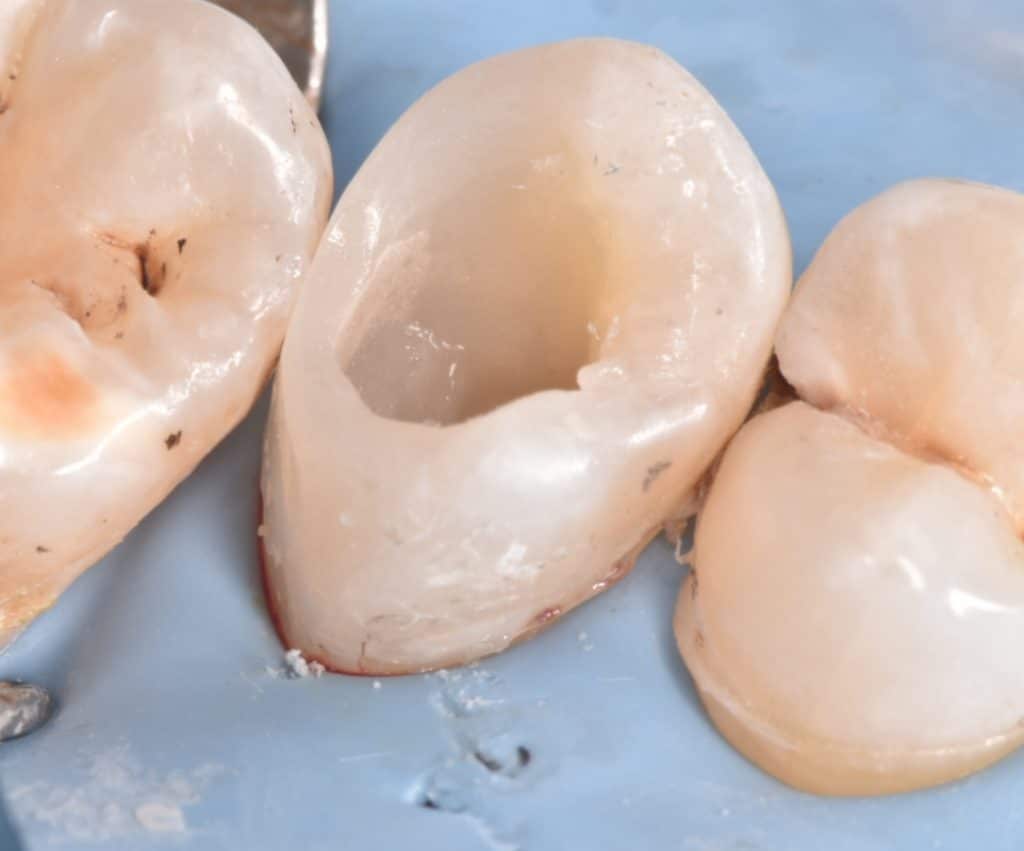 ٢٠٢٢٠١١٨_١٧٢٥٢٥