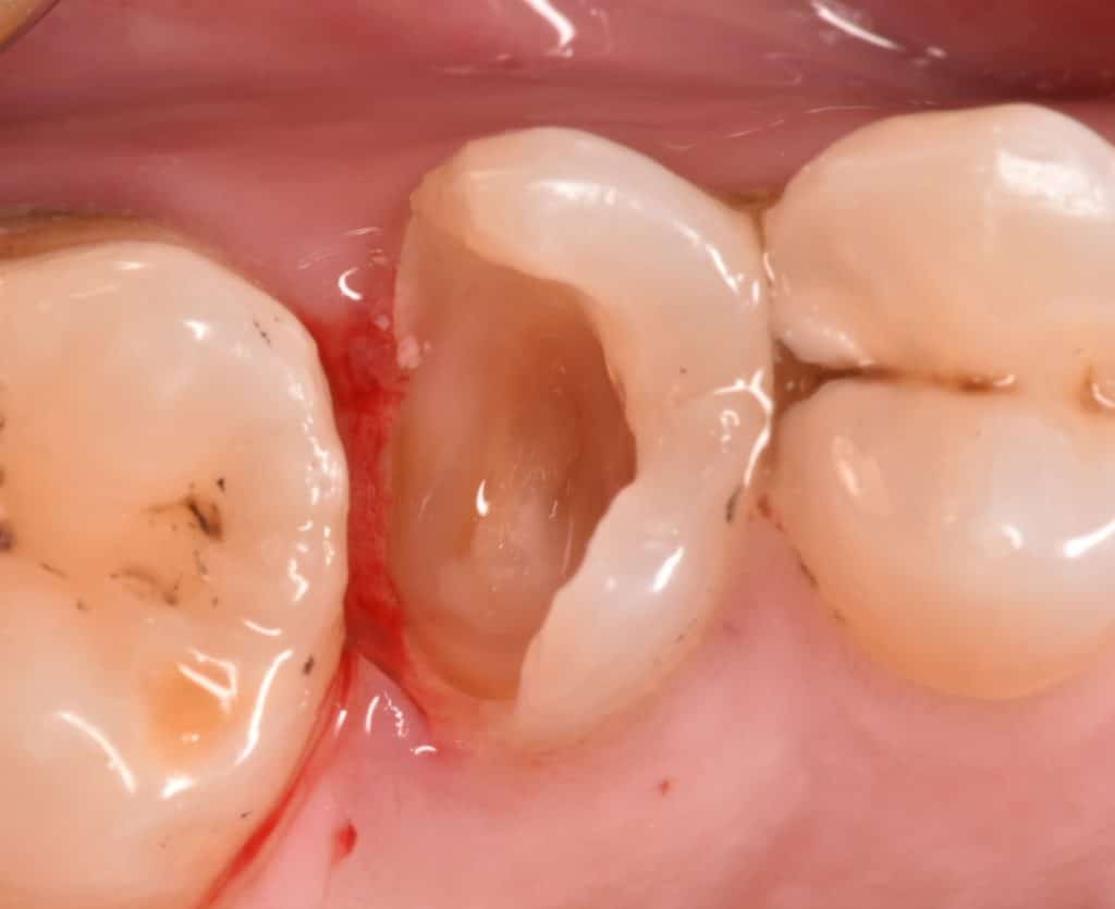 ٢٠٢٢٠١١٨_١٧٢٥٤٣