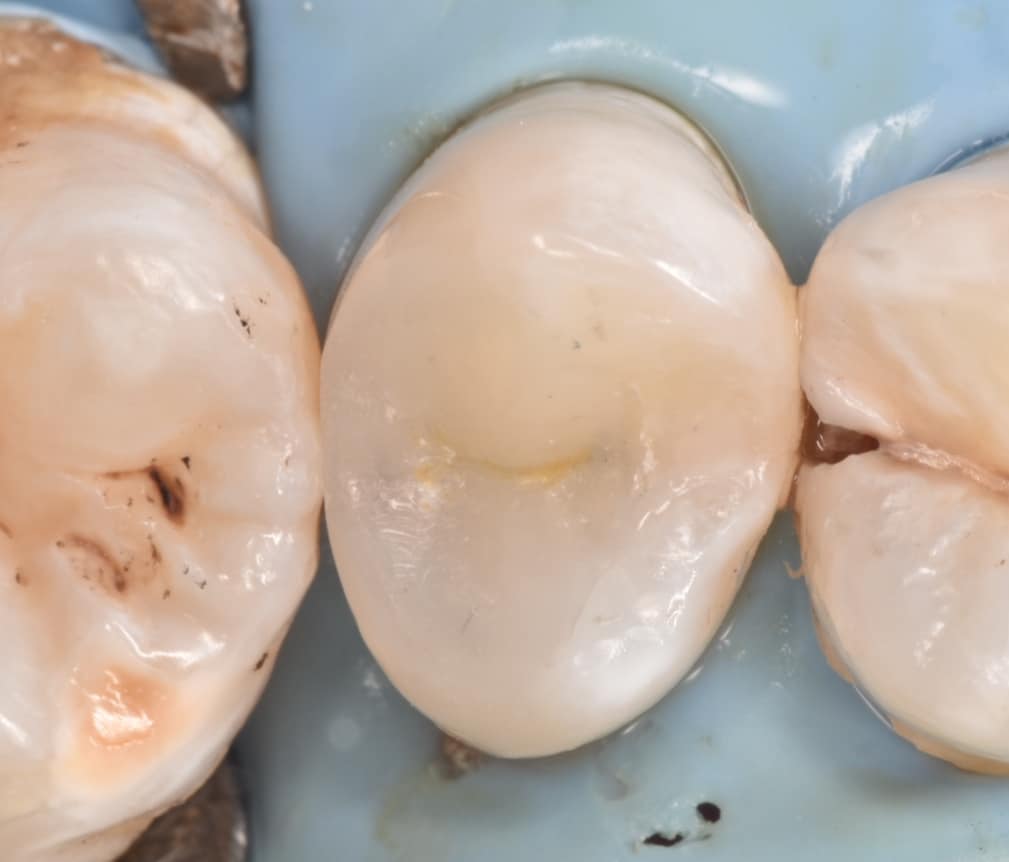 ٢٠٢٢٠١١٨_١٧٢٧٣٥