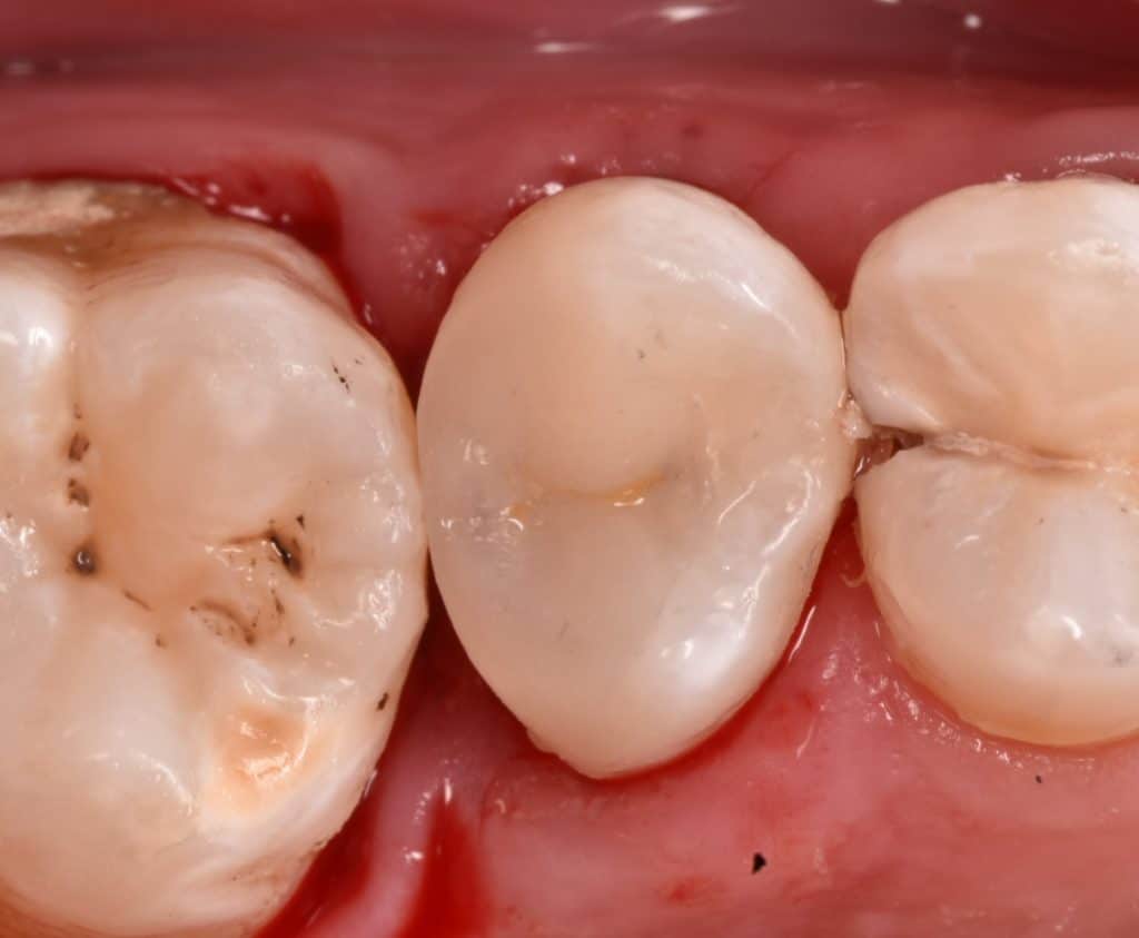 ٢٠٢٢٠١١٨_١٧٢٨٣٠