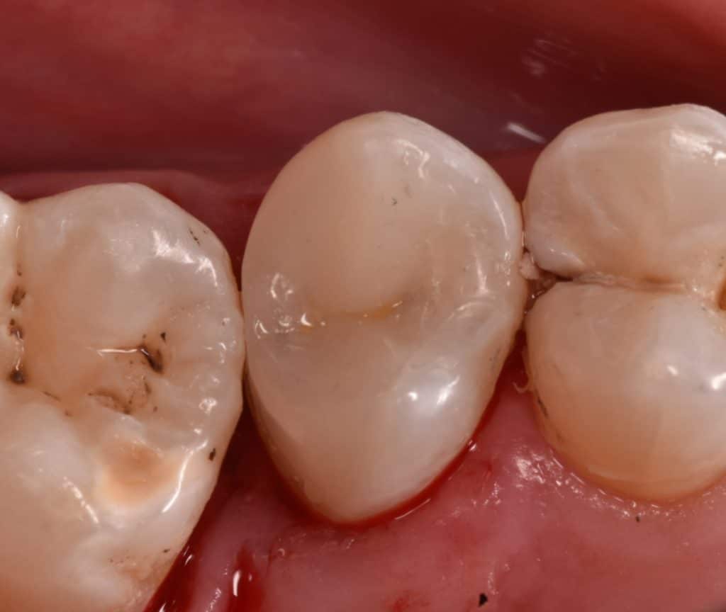 ٢٠٢٢٠١١٨_١٧٢٨٤٢