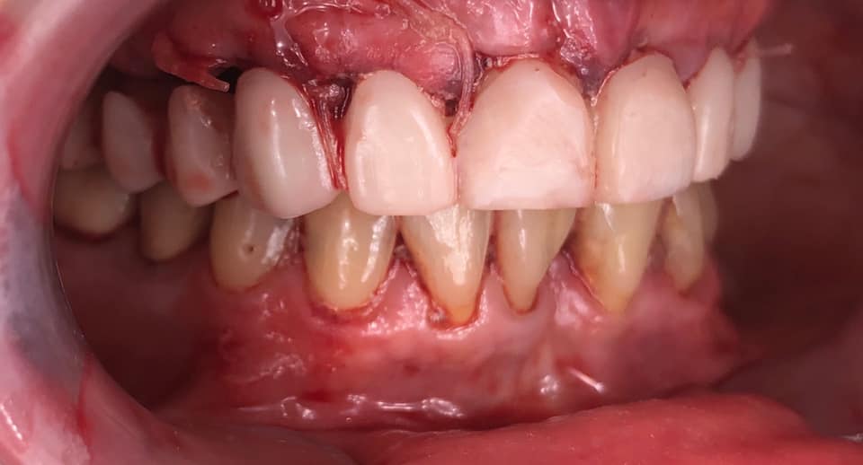 108850396_10105224490925681_5048669816597181847_n