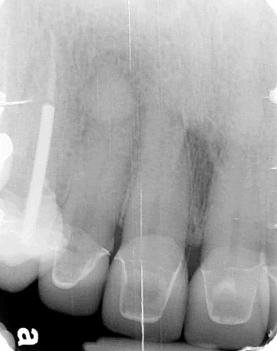 110013421_10105223107218641_3167266245082035013_n